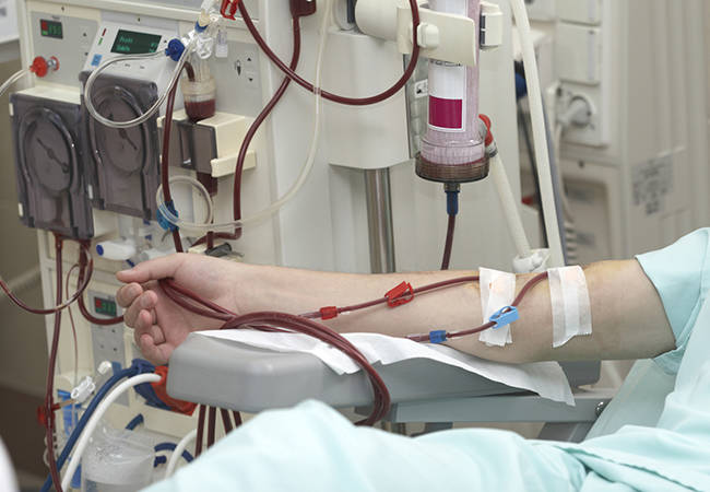 ALCER CASTALIA y ALCER ALICANTE SE ADJUDICAN GESTIÓN DE TRASLADO DE PACIENTES EN HEMODIÁLISIS